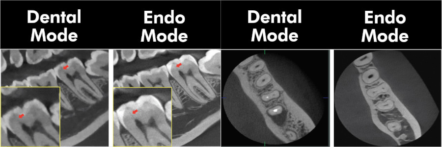 How to Choose the Best CBCT For Your Dental Practice 